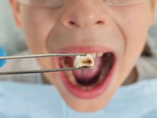 Best After-Hours Emergency Dentist in Fyffe, AL